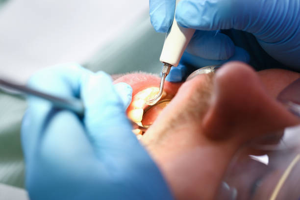 Best Broken or Cracked Tooth Emergency Dentist in Sumter, SC