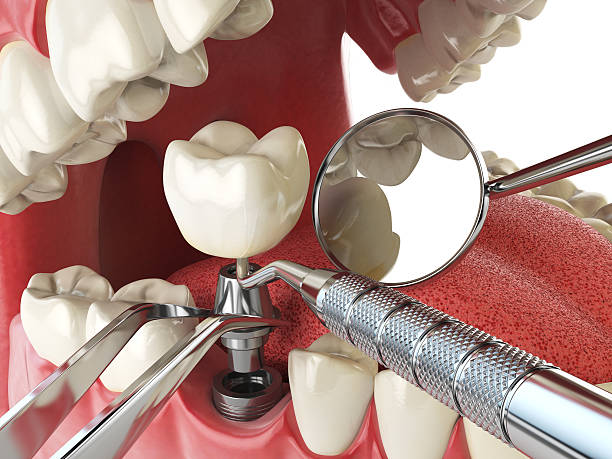 Best Emergency Cosmetic Dentistry in Sumter, SC